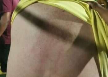 Gervásio garante que irá processar envolvidos no episódio em que foi agredido em Guarabira