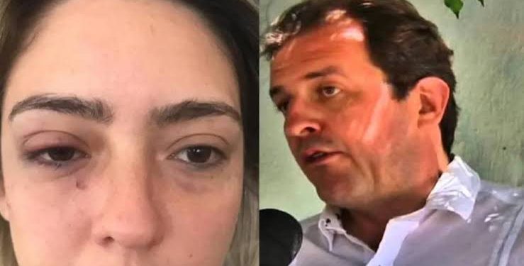 STJ rejeita recurso e mantém condenação contra prefeito de Sousa por agredir ex-namorada
