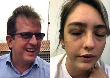 Justiça mantém condenação do prefeito de Sousa por espancamento da ex-namorada