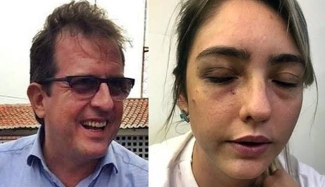 Justiça mantém condenação do prefeito de Sousa por espancamento da ex-namorada