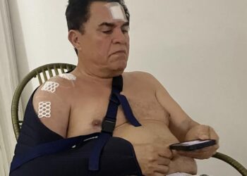 Deputado Wilson Santiago sofre acidente doméstico e passa por cirurgia no ombro