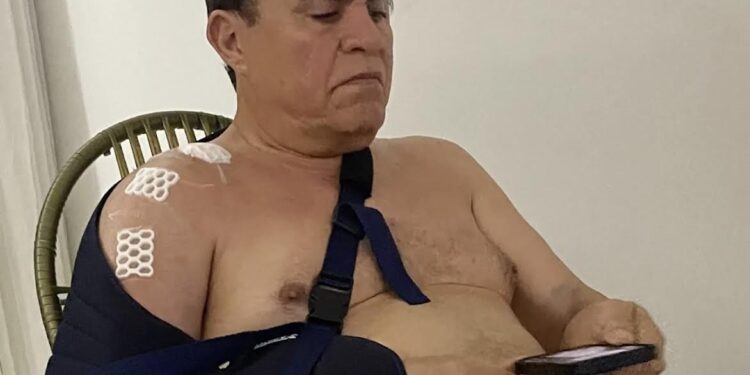 Deputado Wilson Santiago sofre acidente doméstico e passa por cirurgia no ombro