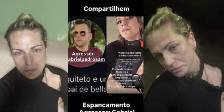 Prima de Léo Bezerra denuncia ter sido agredida por servidor da Prefeitura de Santa Rita